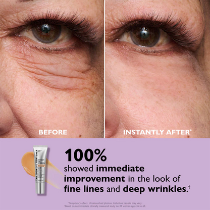 ORVIREXA Instant Lift Eye Gel – Fast Acting for Puffiness & Under Eye Bags, Smooth Fine Lines, 0.34 oz