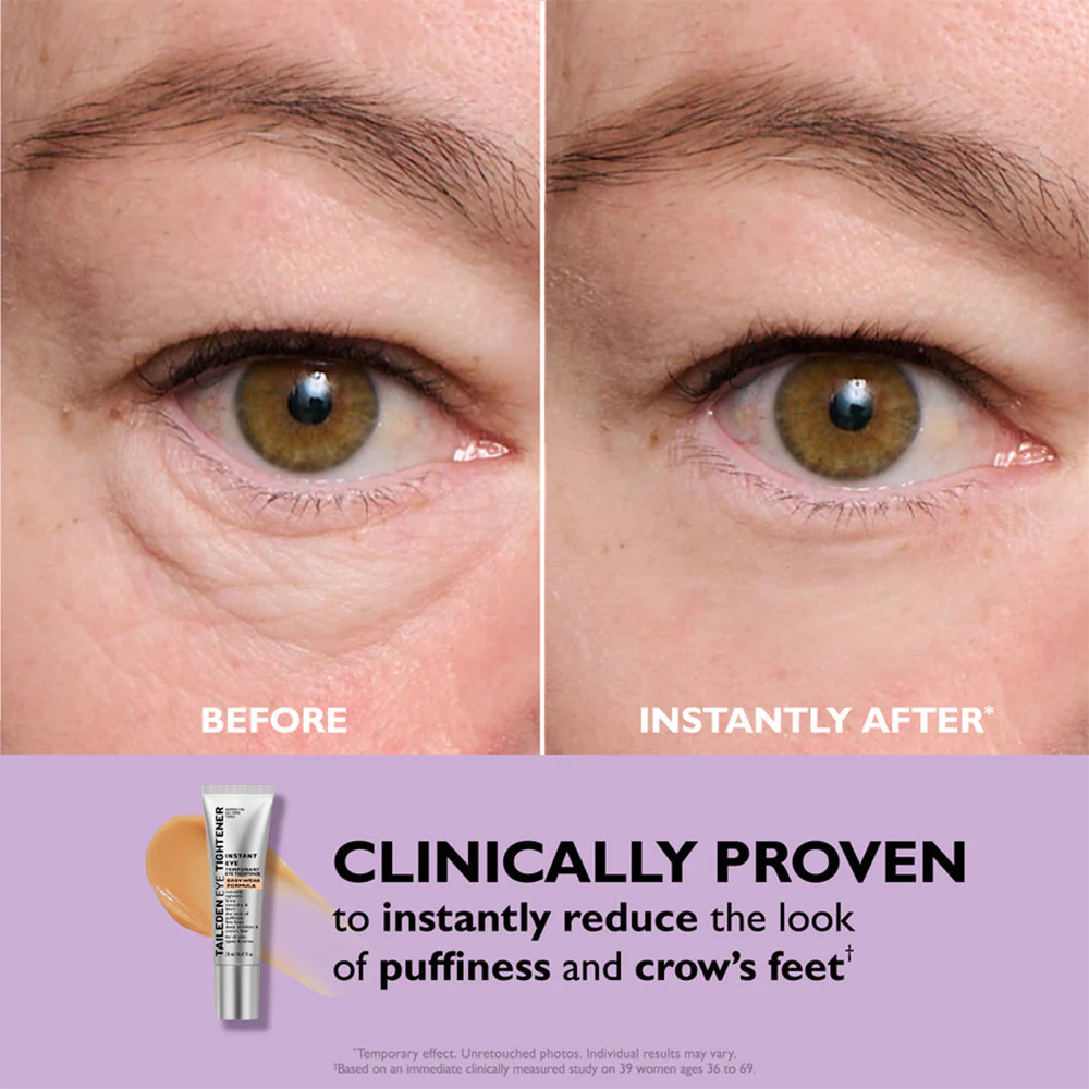 ORVIREXA Instant Lift Eye Gel – Fast Acting for Puffiness & Under Eye Bags, Smooth Fine Lines, 0.34 oz