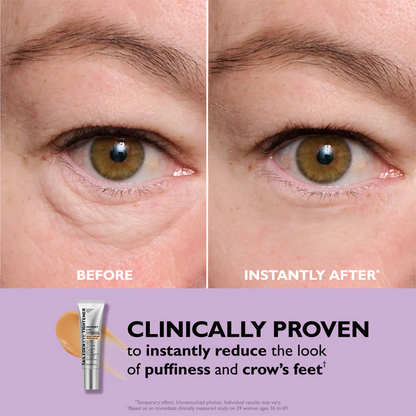 ORVIREXA Instant Lift Eye Gel – Fast Acting for Puffiness & Under Eye Bags, Smooth Fine Lines, 0.34 oz